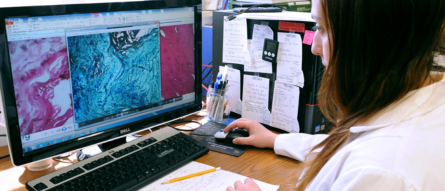 一个女人坐在桌子上,看着电脑屏幕上放大的生物样本。